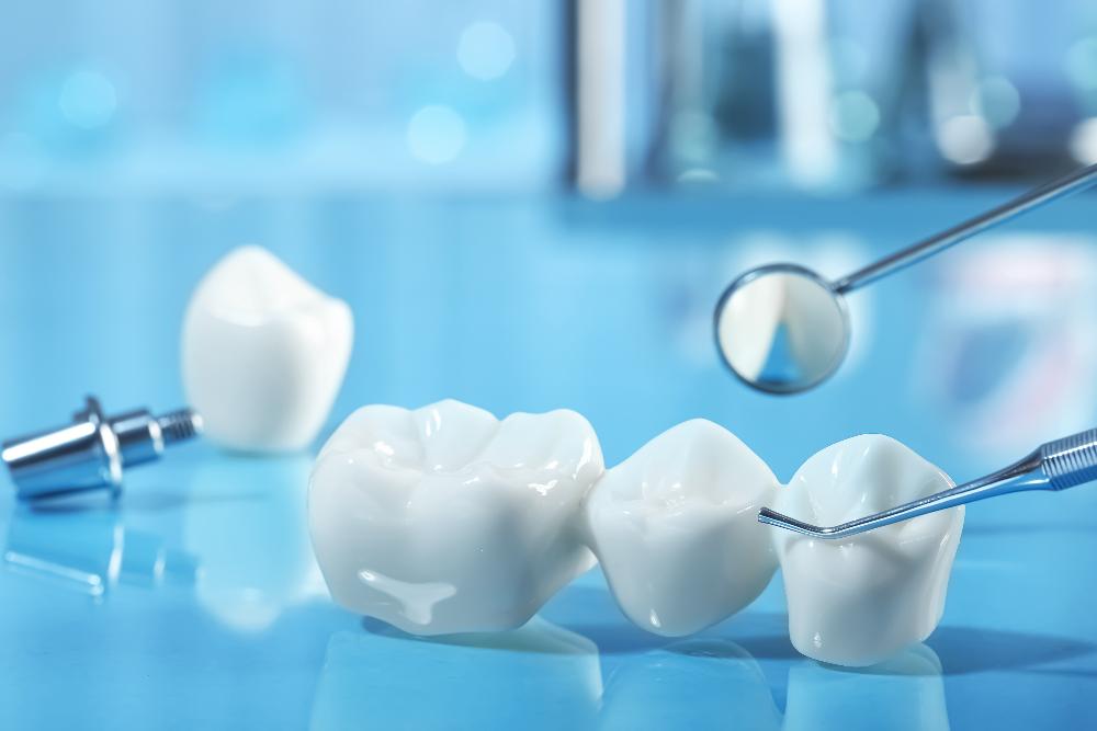 dental crown on tooth in jaw | dental crowns marysville co