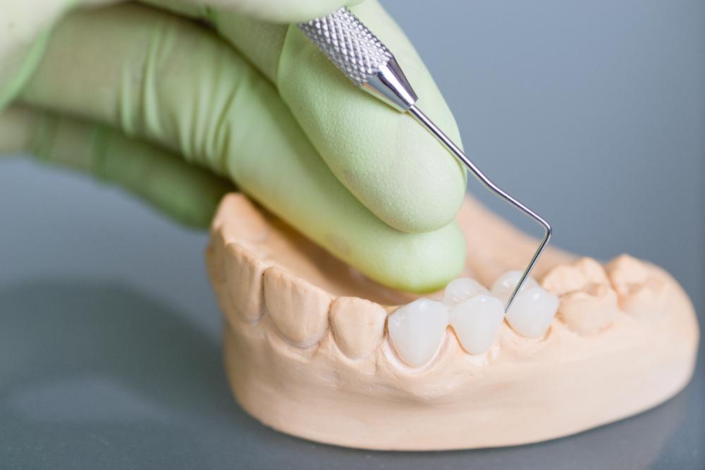 close up of dental implant with dental tool | dental implants marysville wa