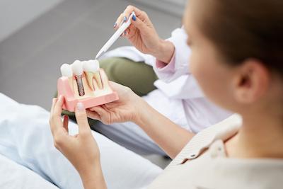 dentist holding dental implant mold | dental implants marysville wa