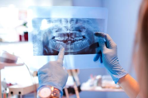 dentist looking at dental x-ray | full smile makeover marysville wa