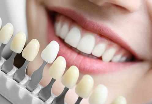 A woman doing a tooth shade comparison | cosmetic dentist marysville wa