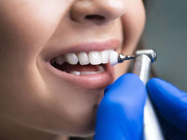 A woman getting her teeth cleaned