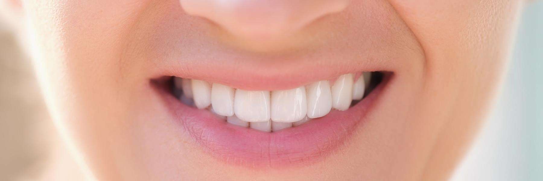 A close-up of a perfect smile | dentist marysville wa