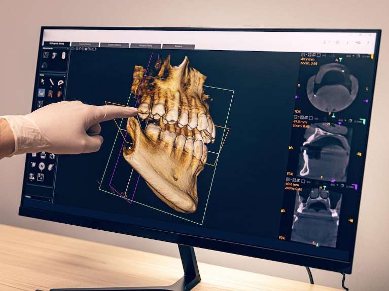 Example of cone beam computed tomography | marysville dental clinic