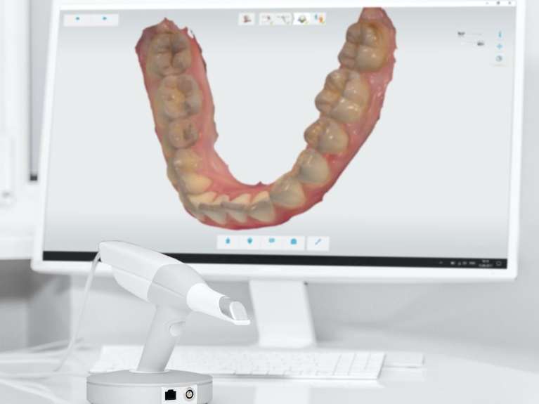 3-D model of a patients' mouth using digital impression technology | dentist marysville