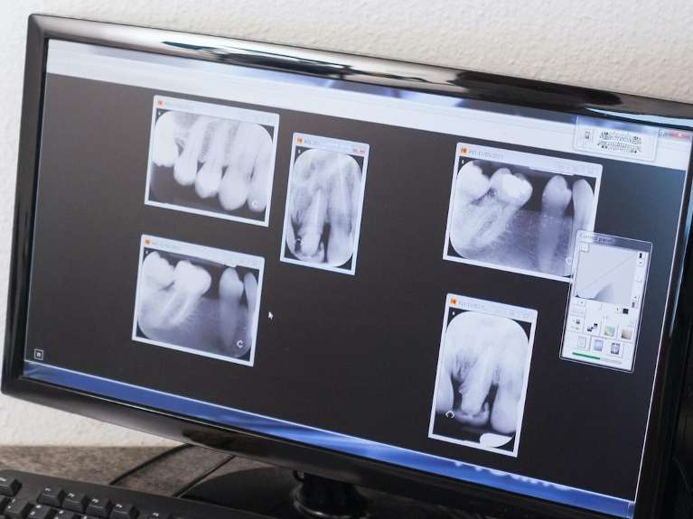 Digital xray images | dentist marysville wa