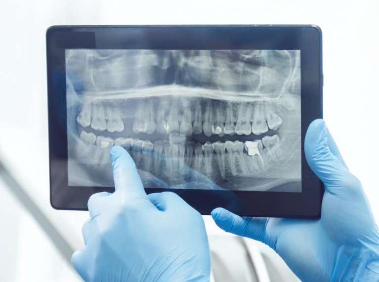 Panoramic x-ray image of teeth | dentist near me